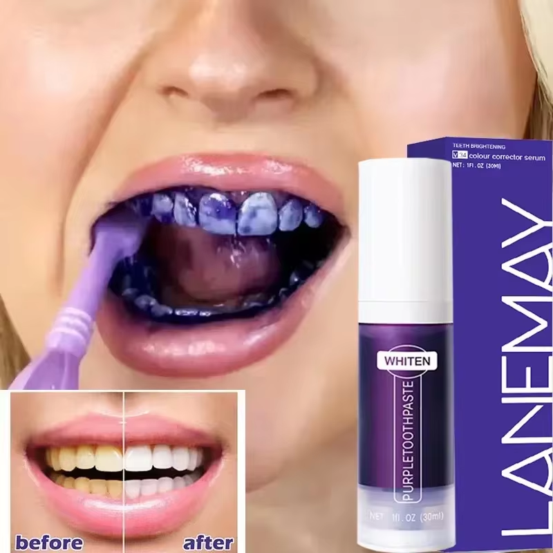 Teeth Whitening Opalescence - V34 Purple Teeth Whitening Toothpaste Remove