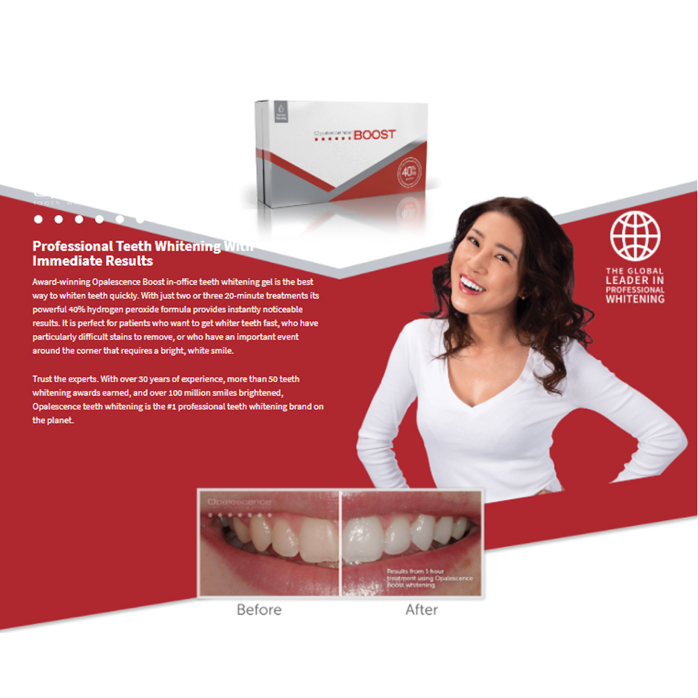 Opalescence Boost 40% PF Ameri - Teeth Whitening Opalescence review and price