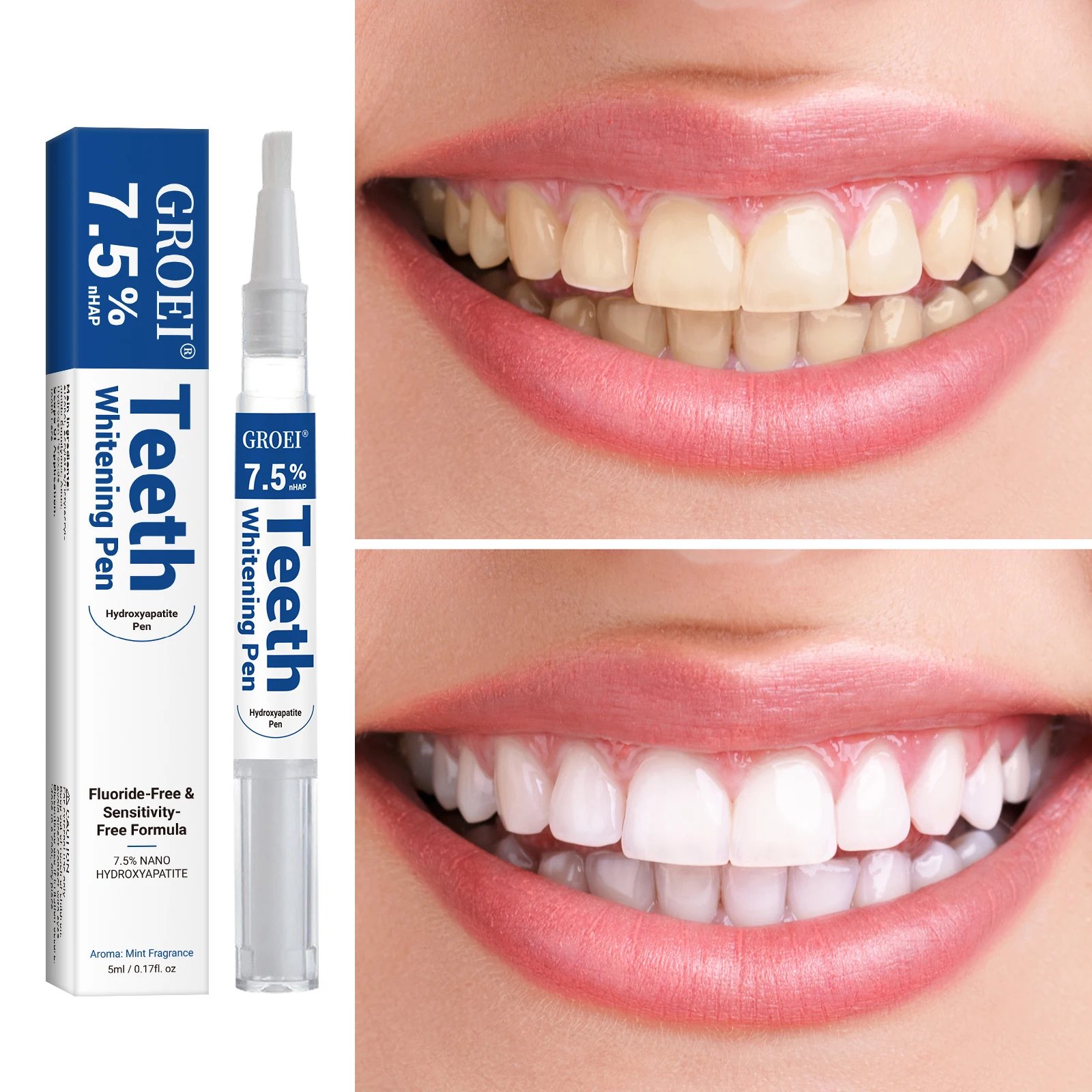 Hydroxyapatite Tooth Whitening - Teeth Whitening Singapore review and price