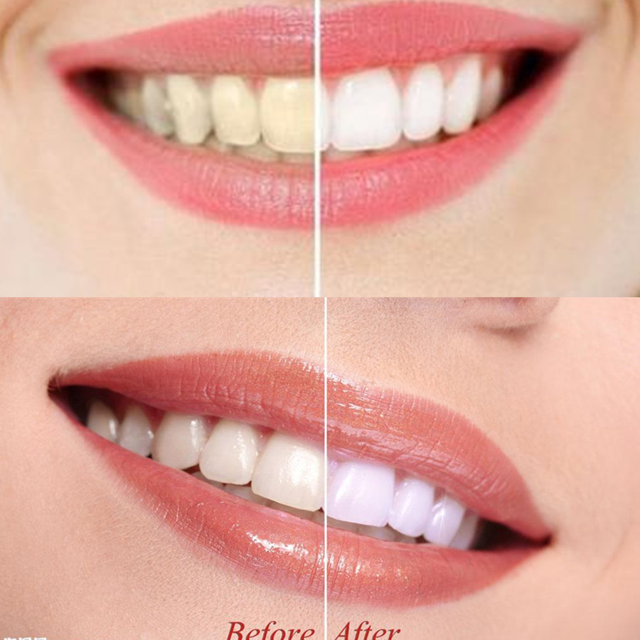 Bamboo Charcoal Teeth Tooth De - Teeth Whitening Street review and price