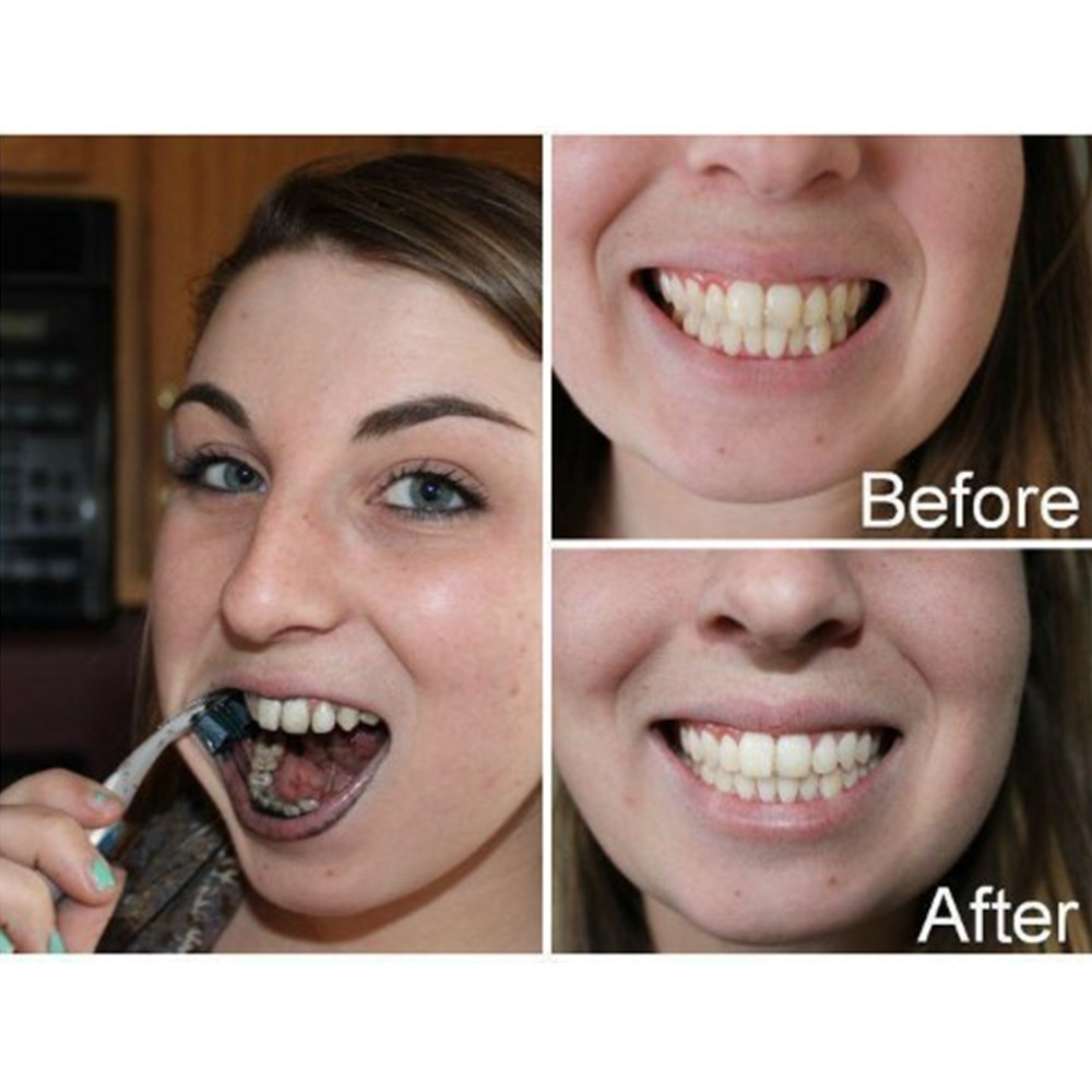 Bamboo Charcoal Teeth Tooth De - Teeth Whitening Street review and price