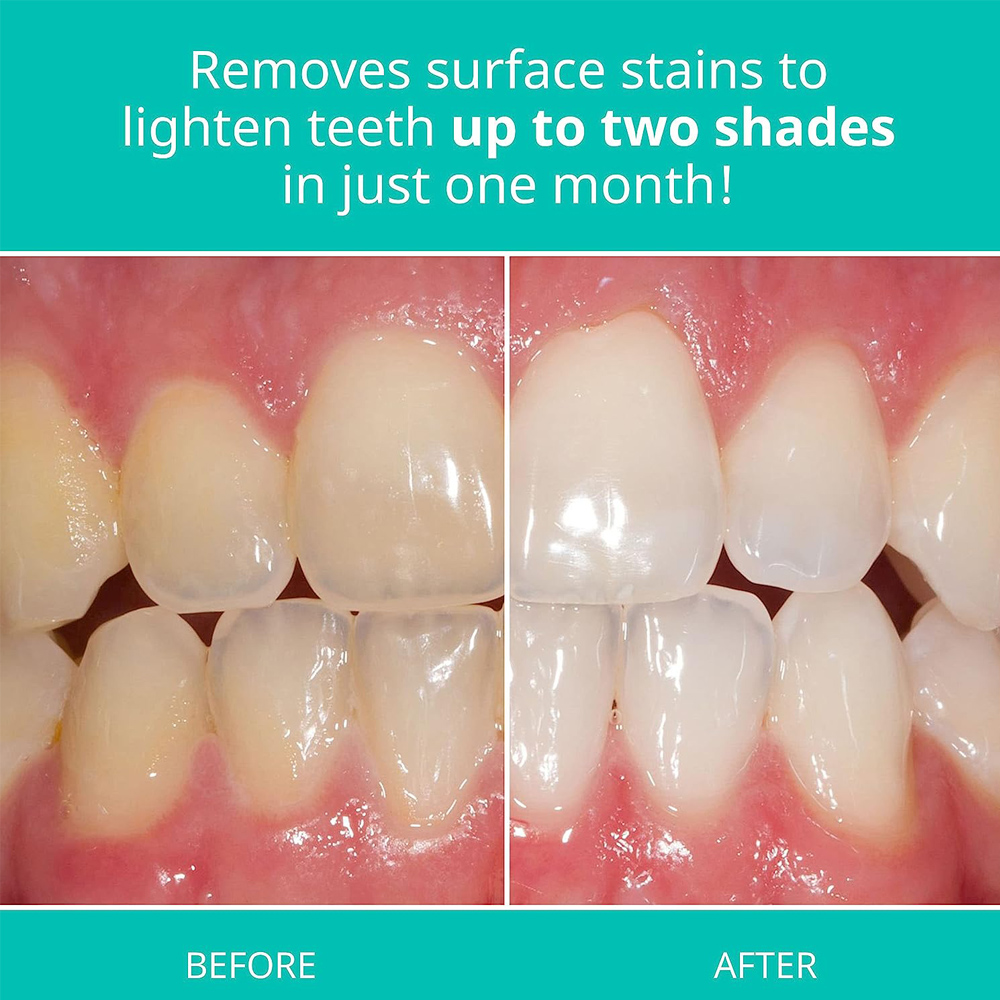 Opalescence Whitening Toothpas - Teeth Whitening Opalescence review and price
