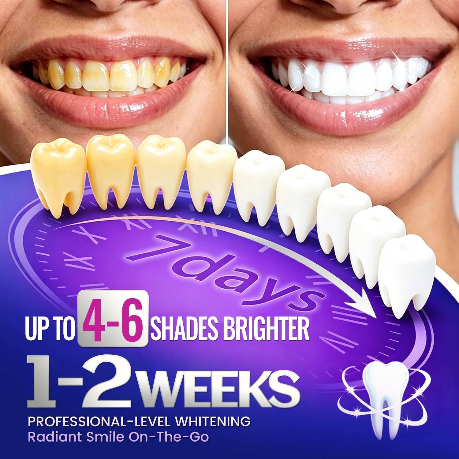 7 pairs Teeth Whitening Strips - Teeth Whitening Street review and price