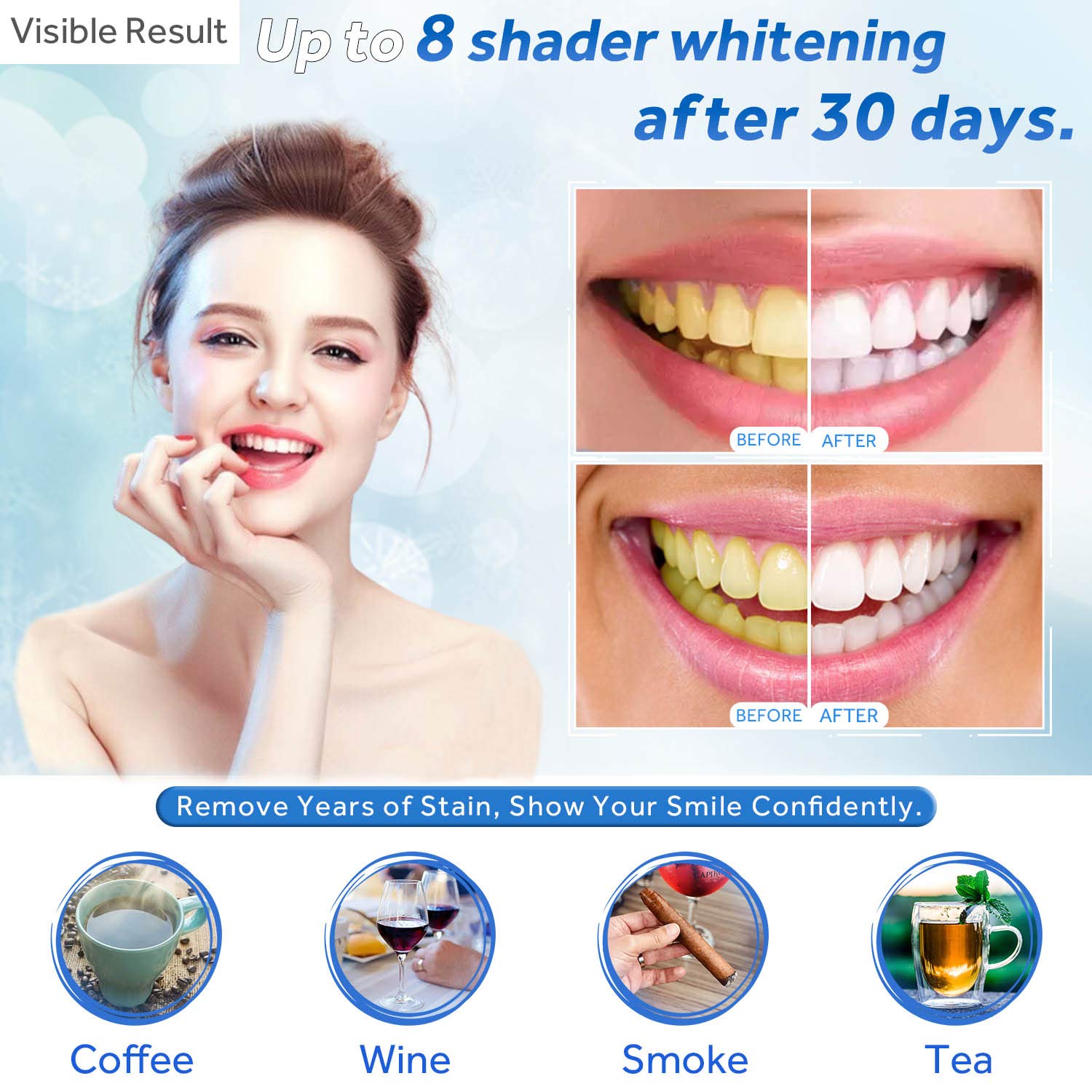 Teeth Whitening Gel Refill Syr - Teeth Whitening Singapore review and price
