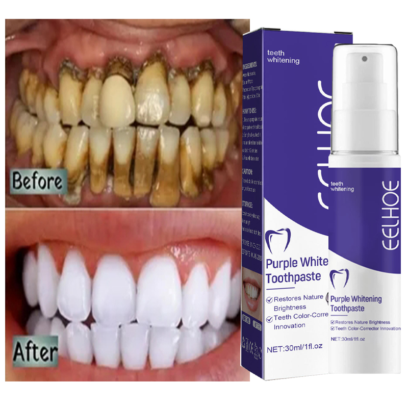 1pcs Teeth Cleansing Whitening - Teeth Whitening Opalescence review and price