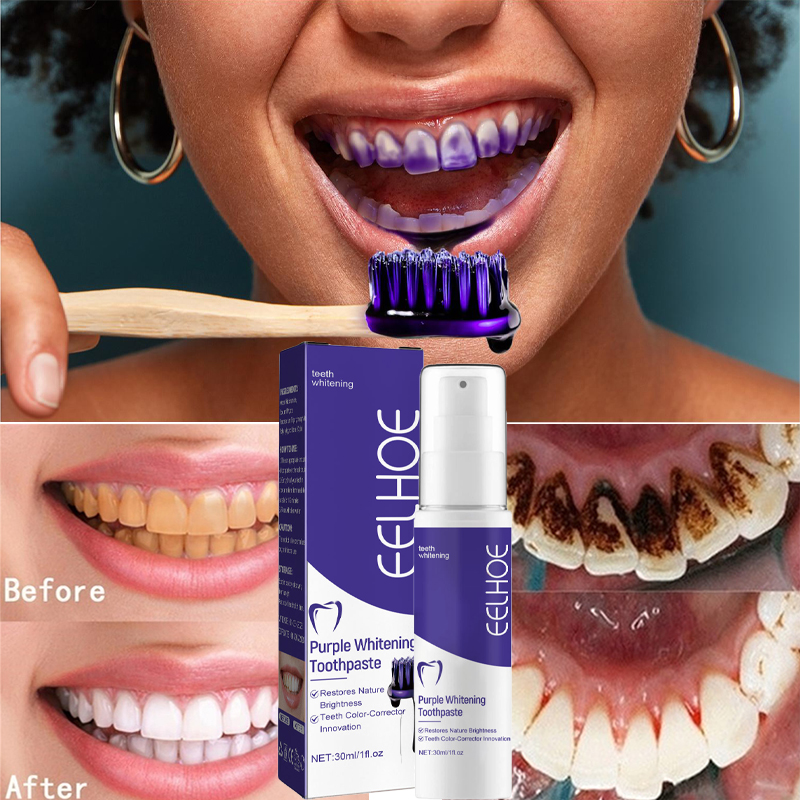 1pcs Teeth Cleansing Whitening - Teeth Whitening Opalescence review and price