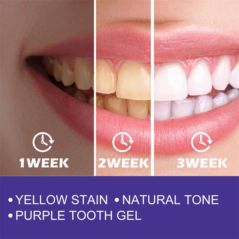 1pcs Teeth Cleansing Whitening - Teeth Whitening Opalescence review and price
