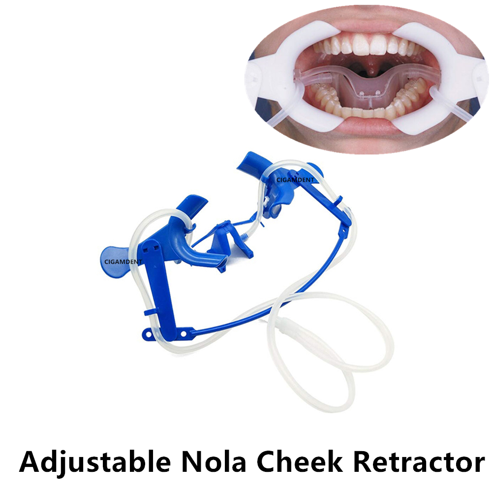 1Set Dental Lip Cheek Retracto - Teeth Whitening Youtube review and price