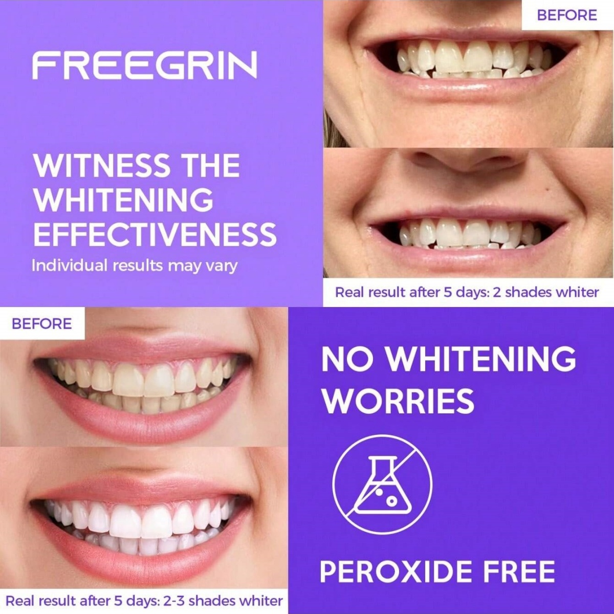 Deluxe Whitening Teeth Sticker - Teeth Whitening Street review and price